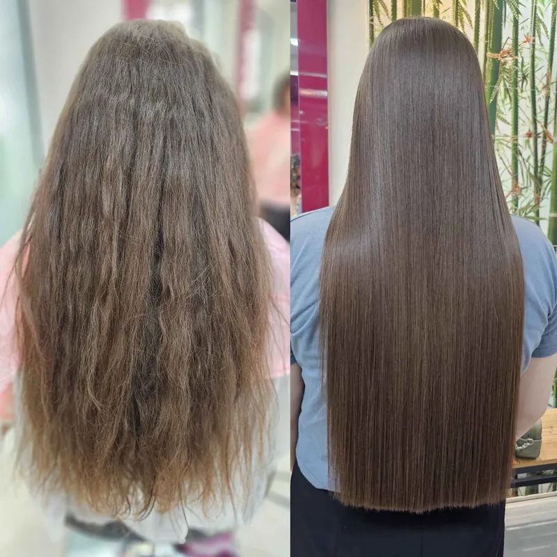 آنزیم تراپی 