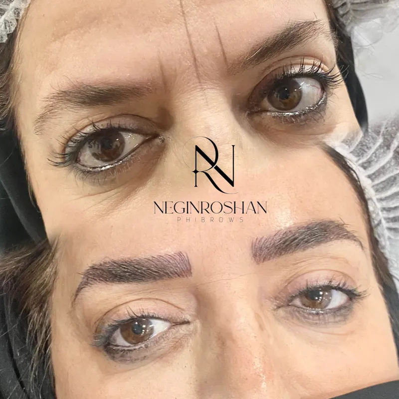 میکرو کرکی مویی نچرال