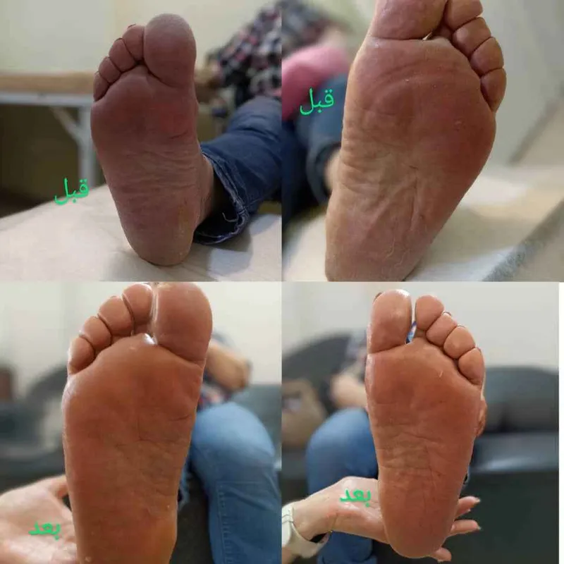 پارافین تراپی پا 