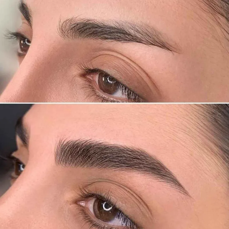 فیبروز ابرو