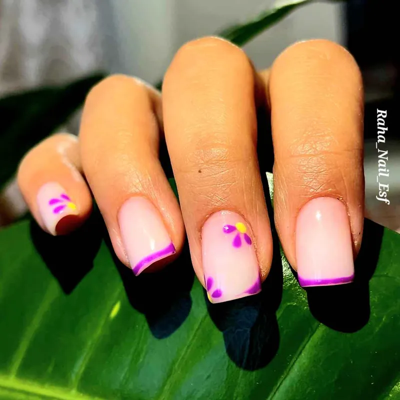 ترمیم کاشت ژل