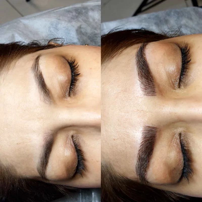 میکروبلیدینگ وطرح بدن