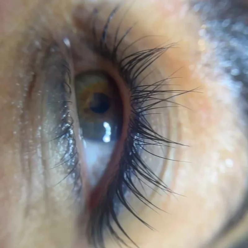 خدمات لیفت و لمینت مژه به همراه بوتاکس تراپی رایگان 