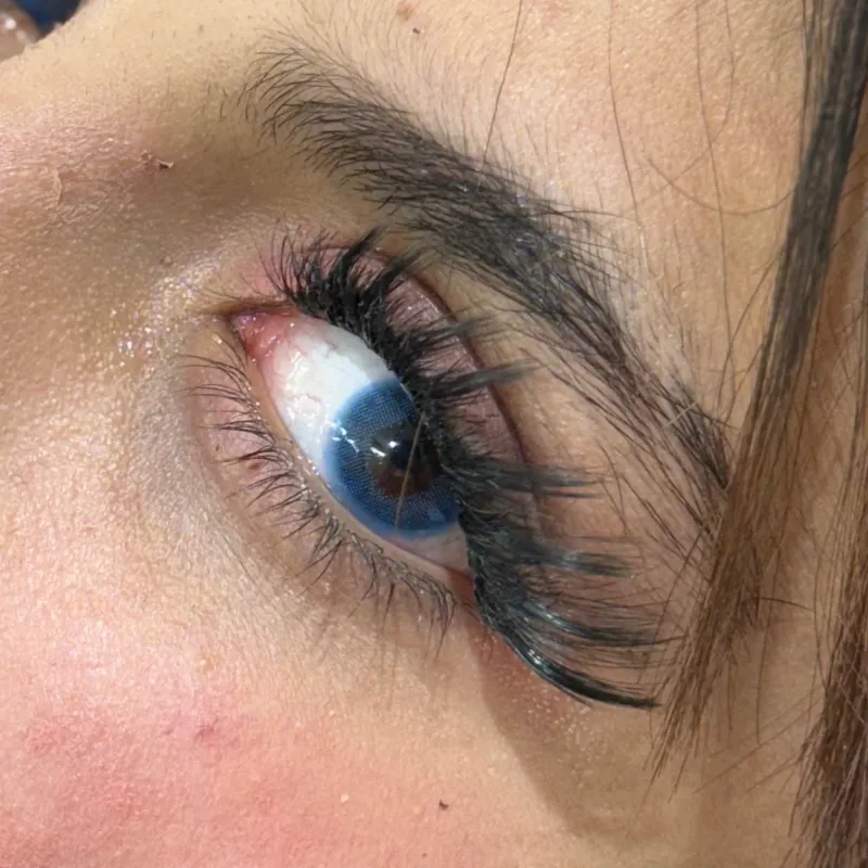 کاشت مژه هیدن