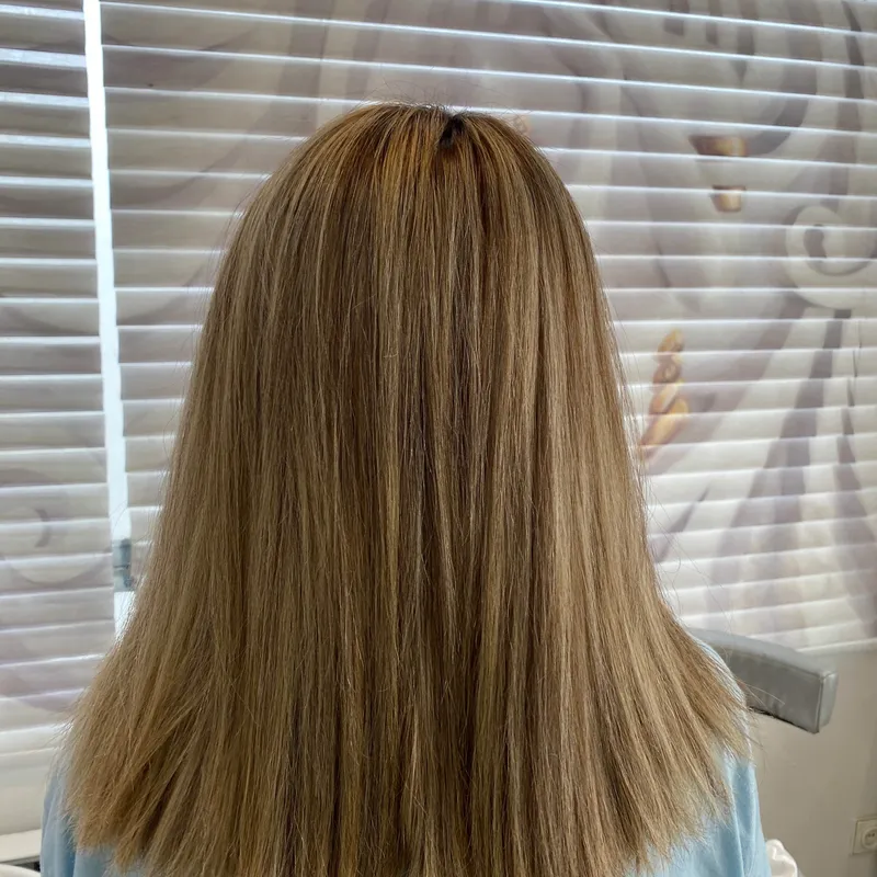 بوتاکس تراپی 