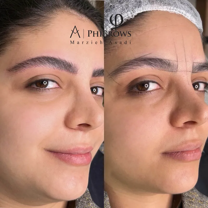 میکروبلیدینگ به سبک نچرالبروز