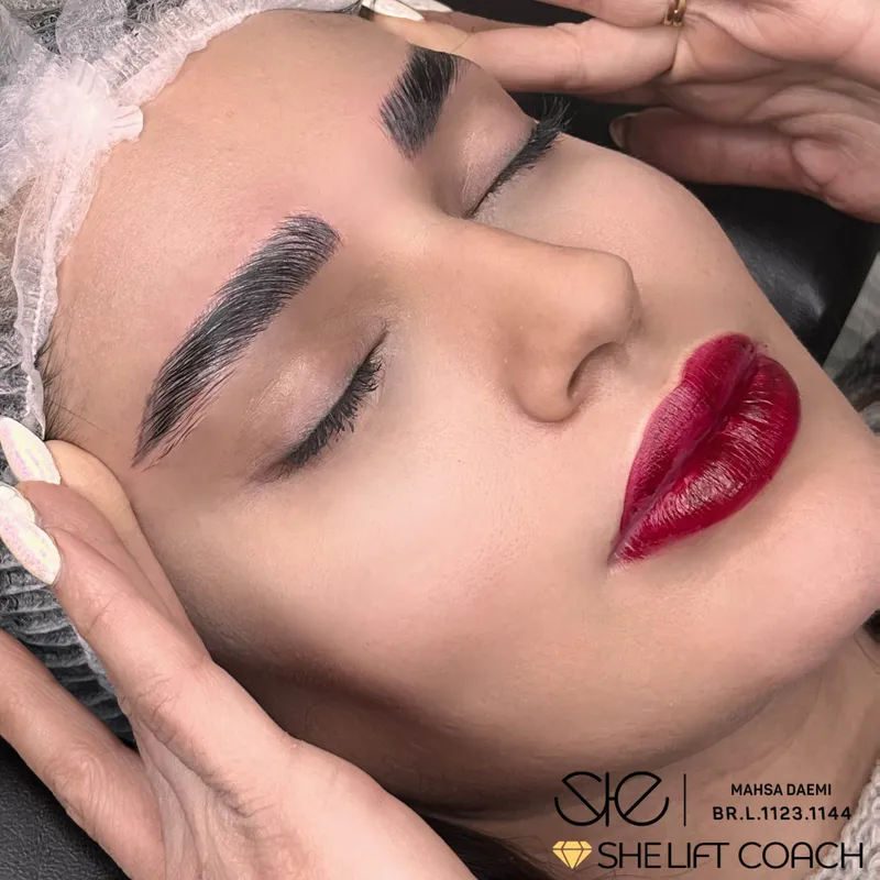 لیفت و بوتاکس ابرو