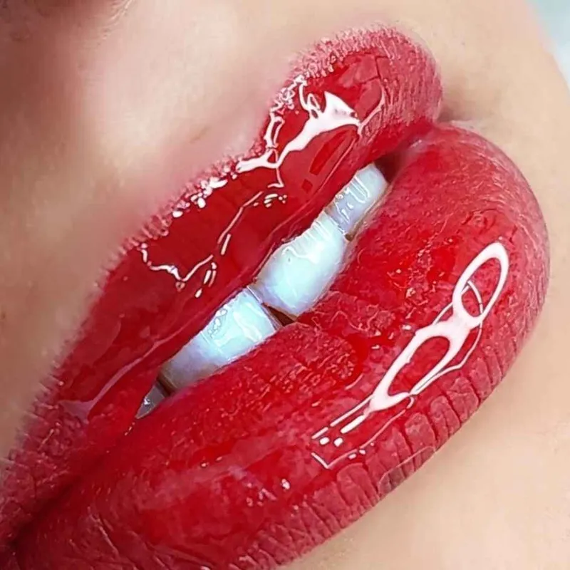 معجزه ی رفع کبودی لب