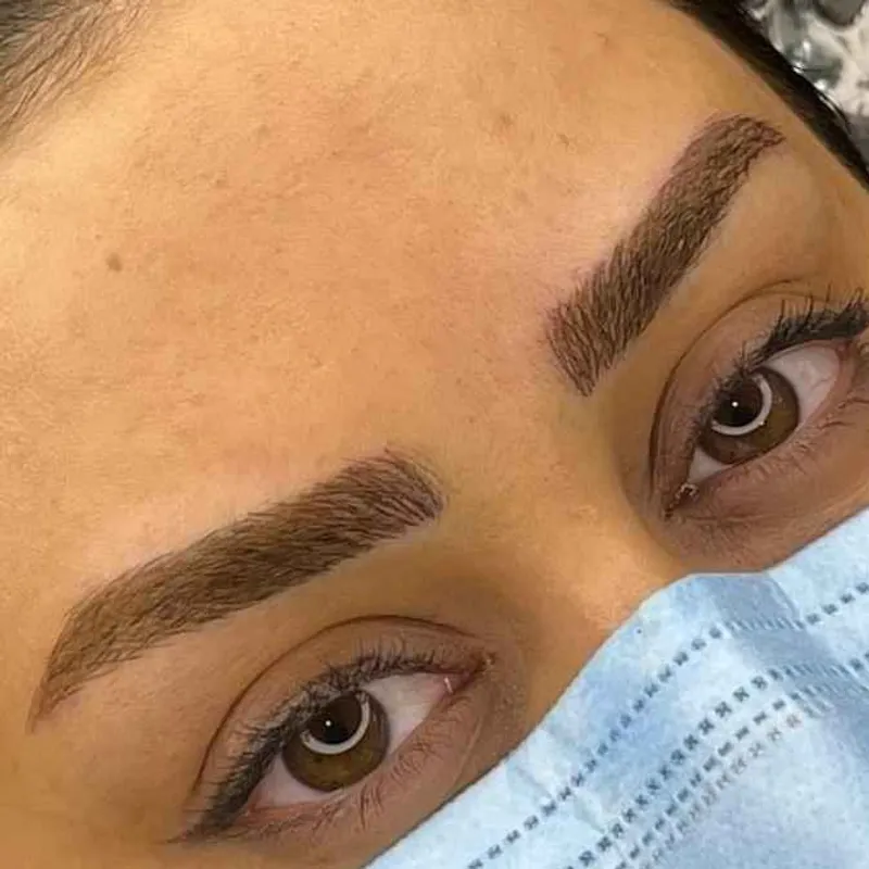 میکروبلیدینگ