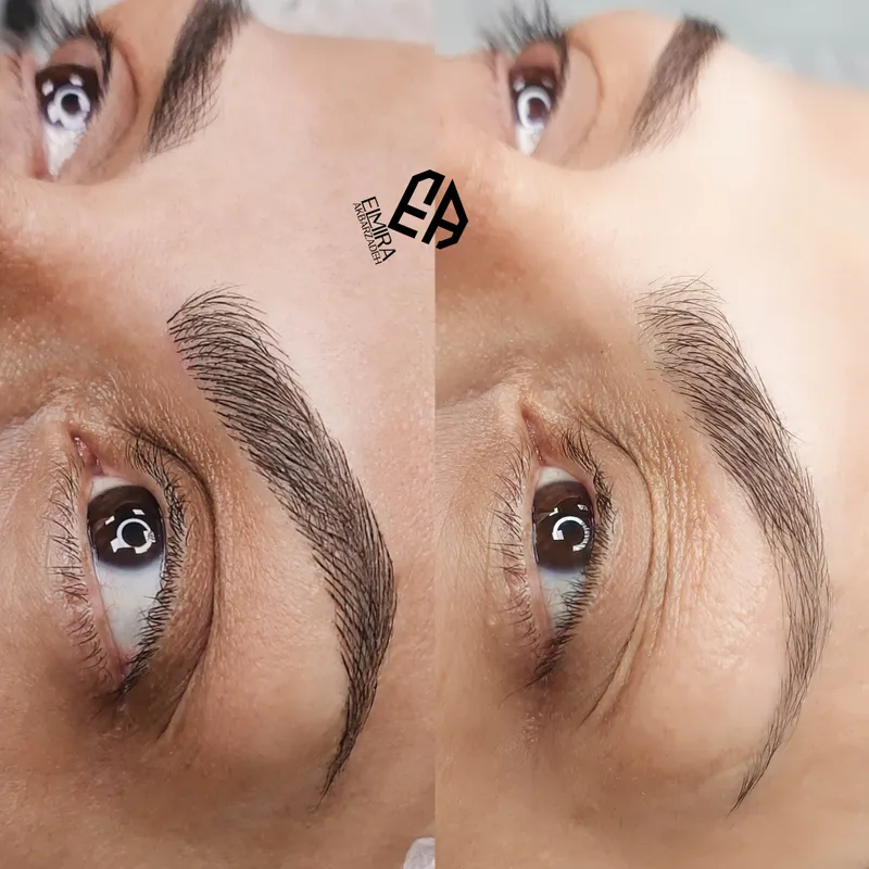 میکروبلیدینگ