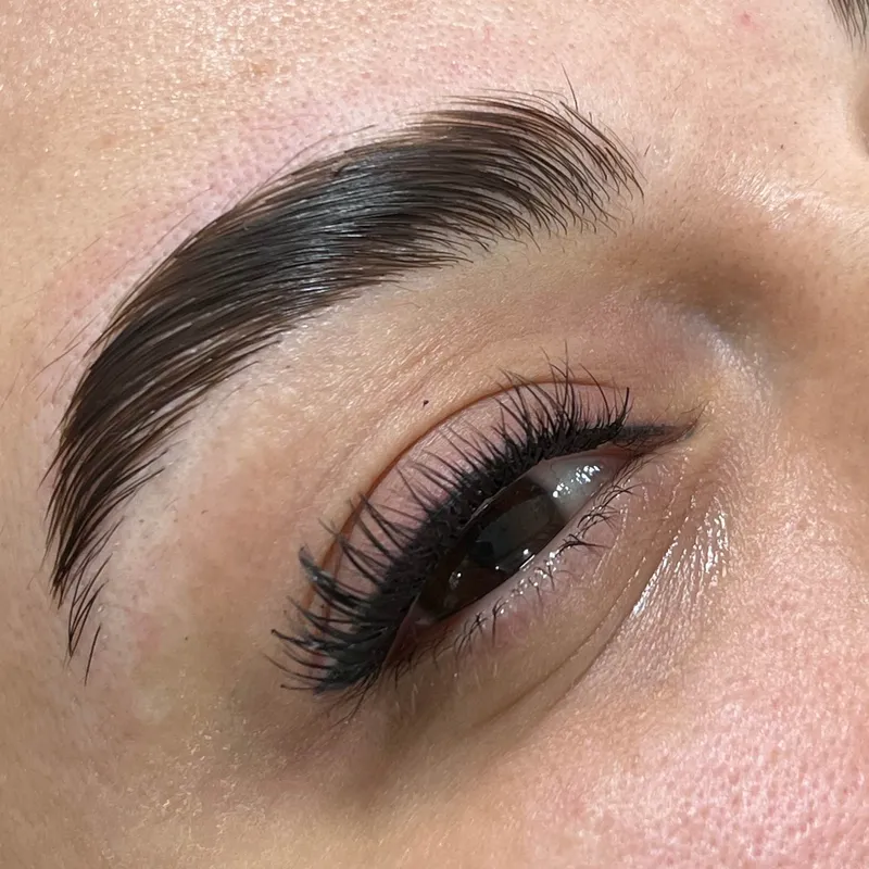 لیفت ابرو و کاشت هیدن