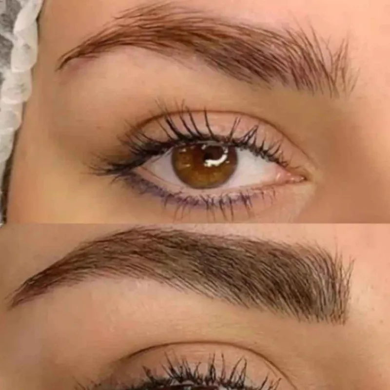 میکروپیگمنشن ابرو