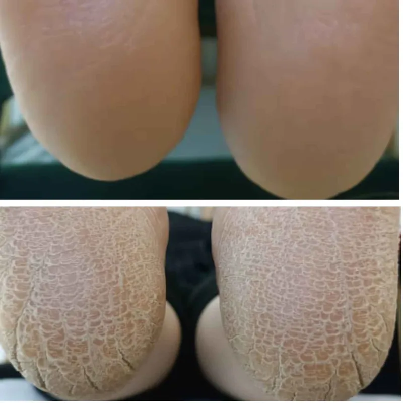 پدیکور درمانی