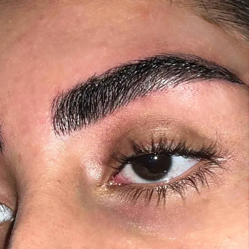 فیبروز ابرو 