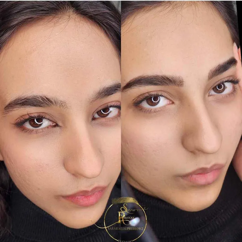 فیبروز ابرو