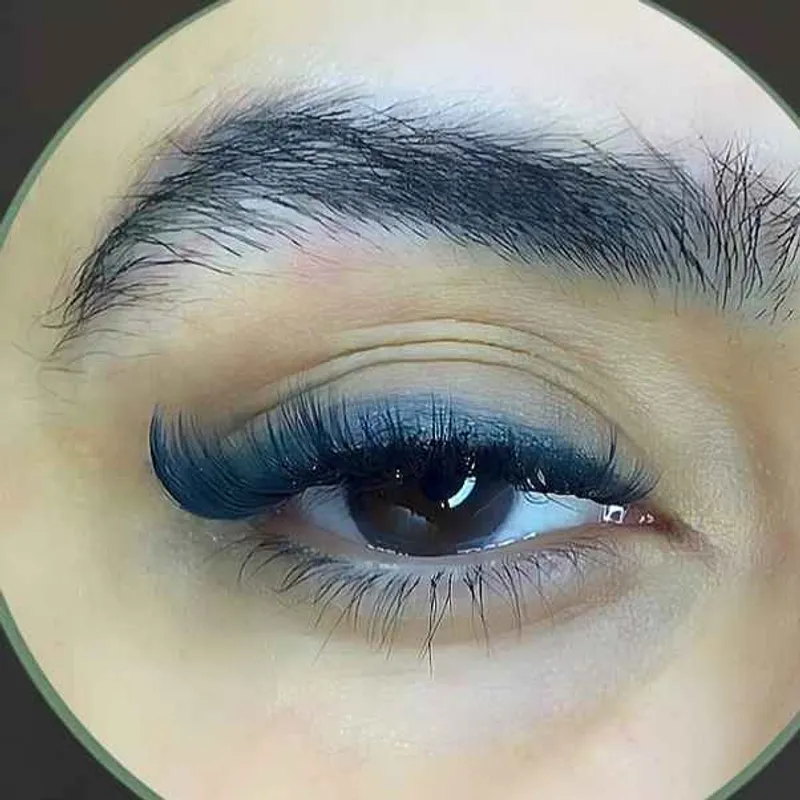 ترمیم والیوم