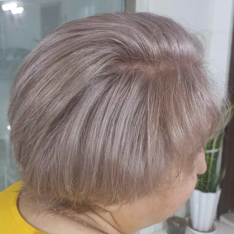 کوتاهی ، رنگ موی سفید 