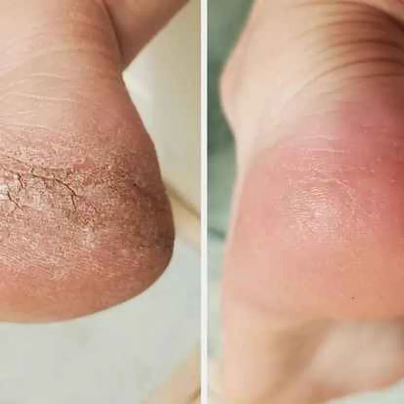 پدیکور پای بانوان