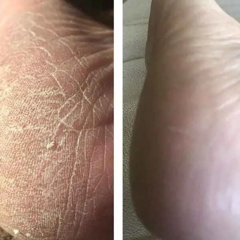 پدیکور بانوان