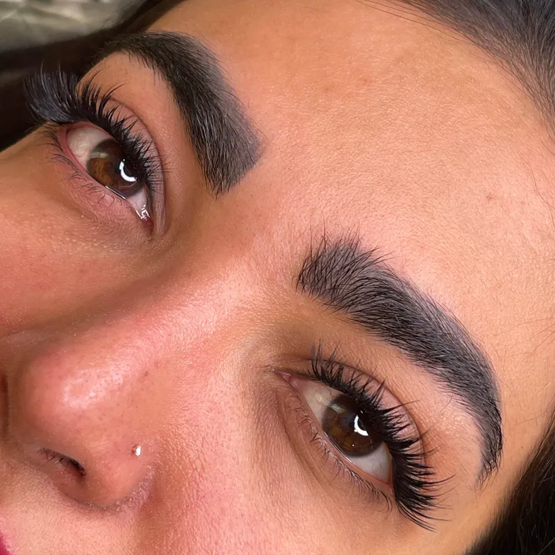 کاشت موقت و هیدن مژه