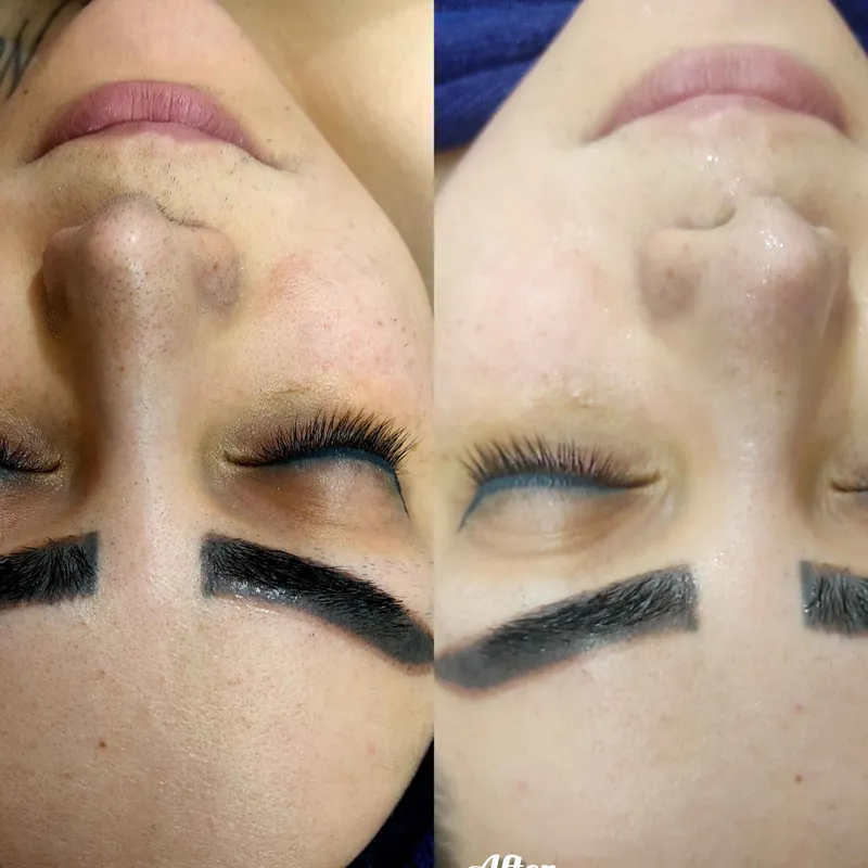 فیشال تخصصی