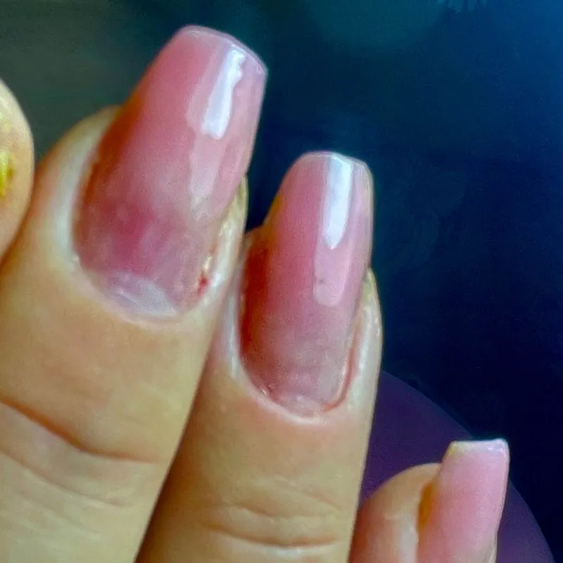  ترمیم  مربع