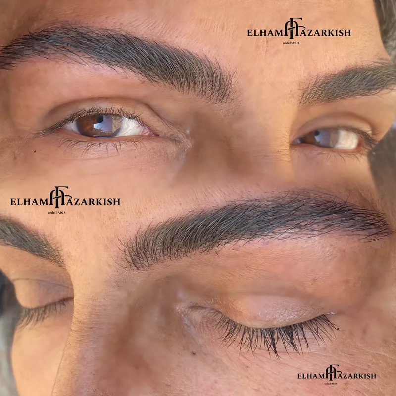 میکروبلیدینگ