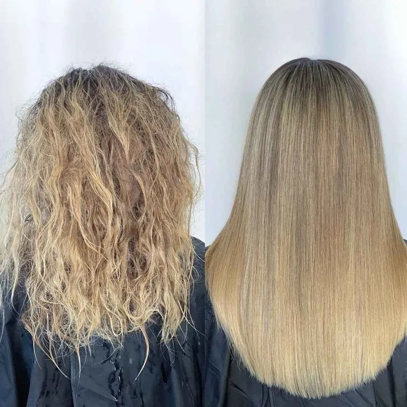 خاویارتراپی 