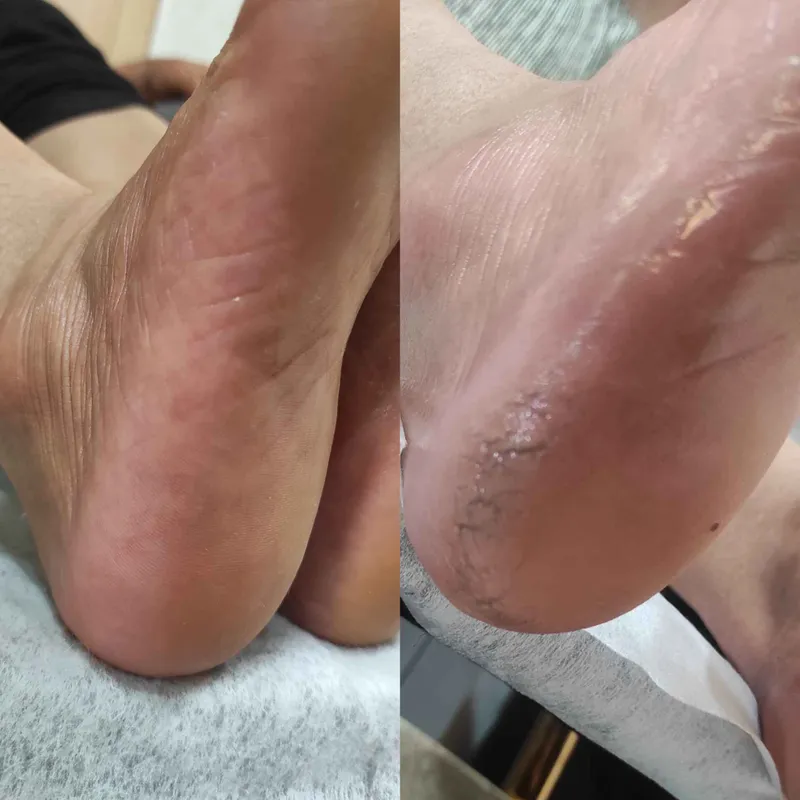 پدیکور درمانی 