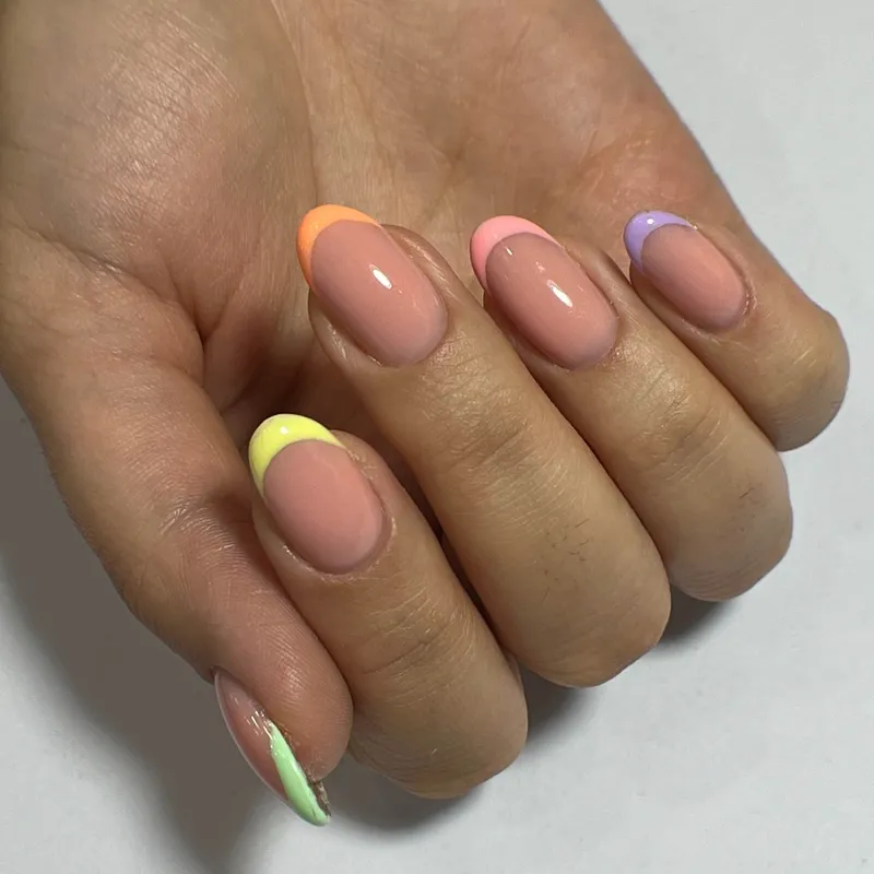 کاشت ژل با متد روسی 