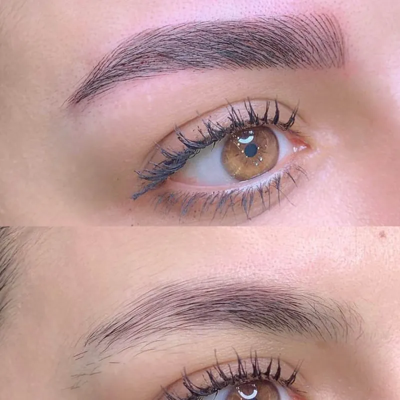 طبیعیترین فیبروز 