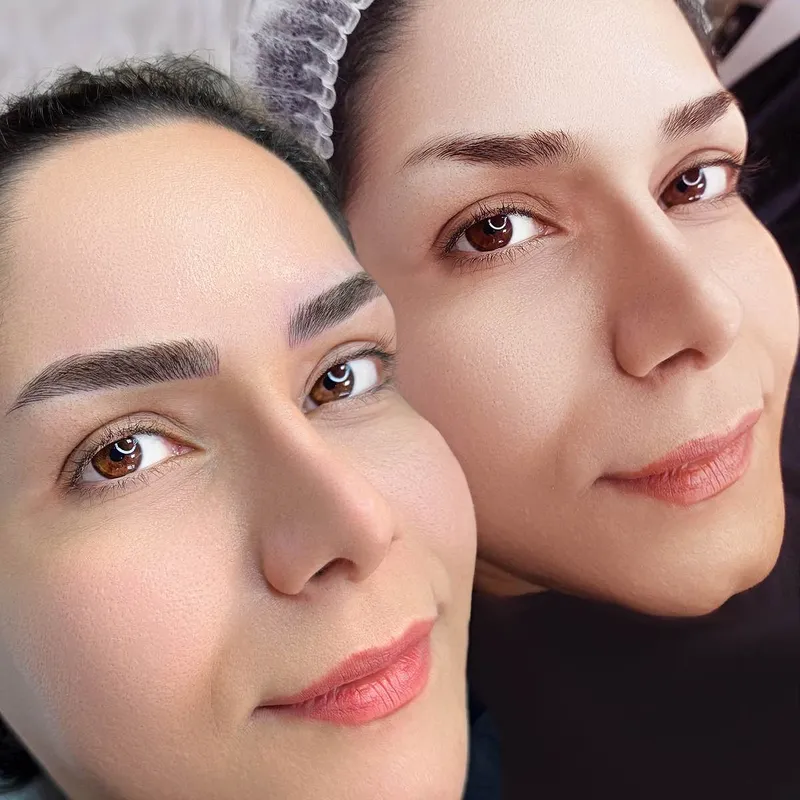 میکروبلیدینگ