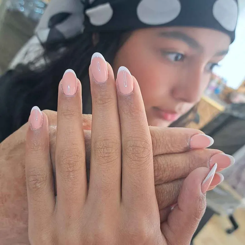 کاشت فرنچ سفید با فرم بیضی