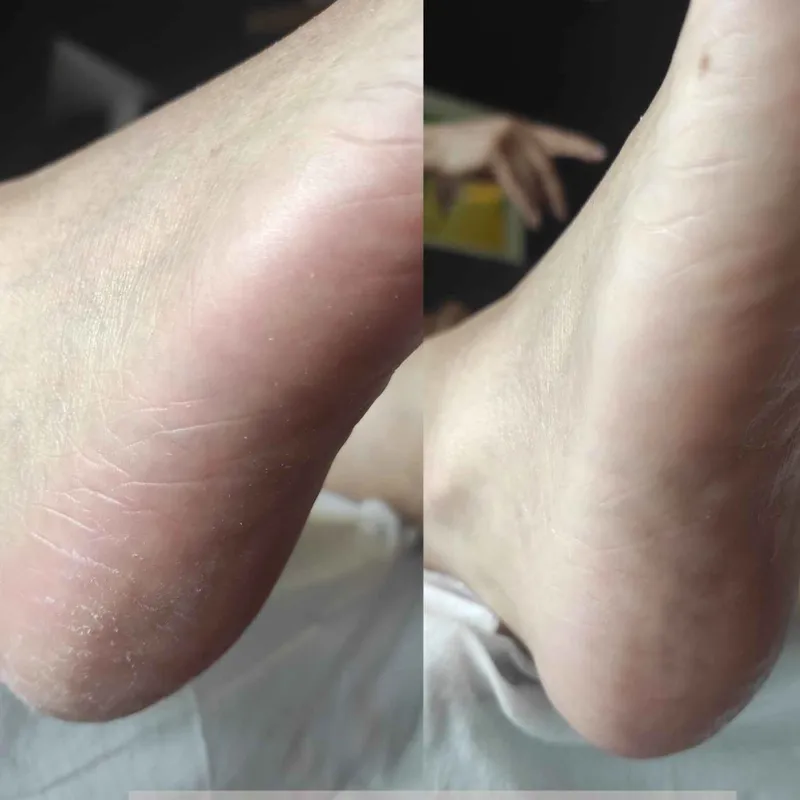 پدیکور درمانی 