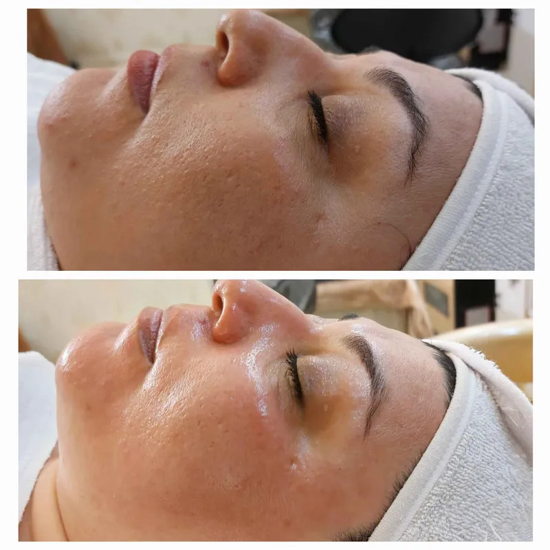 فیشال آبرسانی 