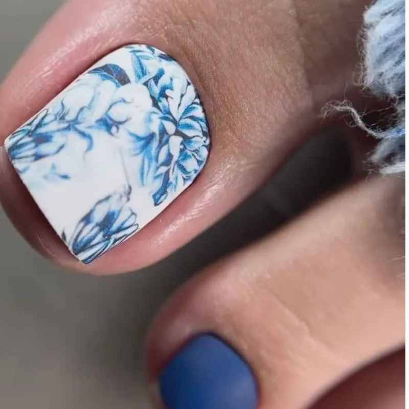 کاشت ناخن پا