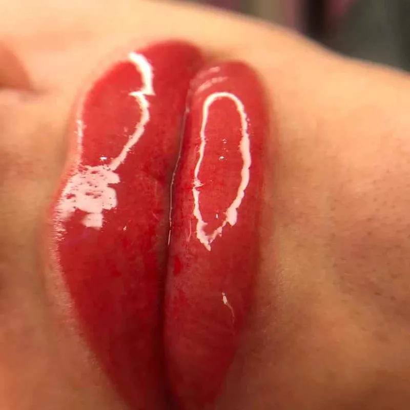 میکروبلیدینگ 