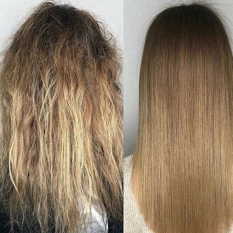 پروتئین تراپی