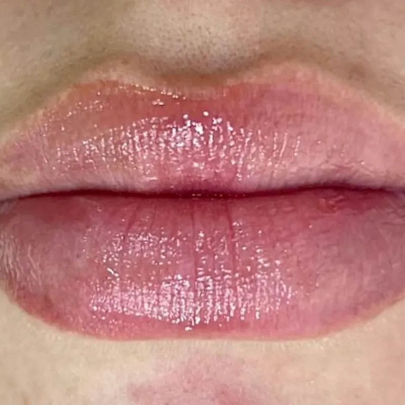 آبرسانی و جوانسازی لب