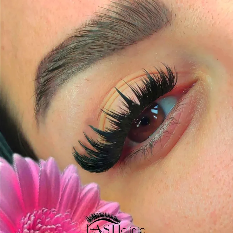 کاشت هیدن کایلی