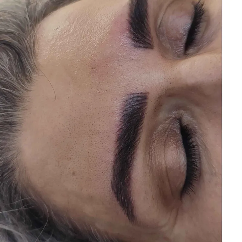 فیبروز ابرو 