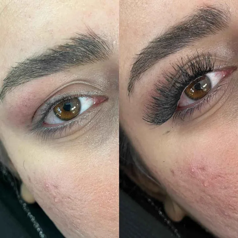 فیبروزابرو 