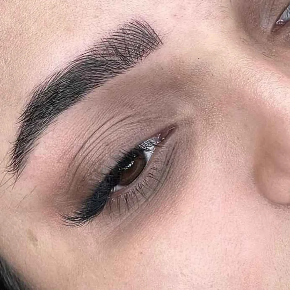 میکرو بلیدینگ