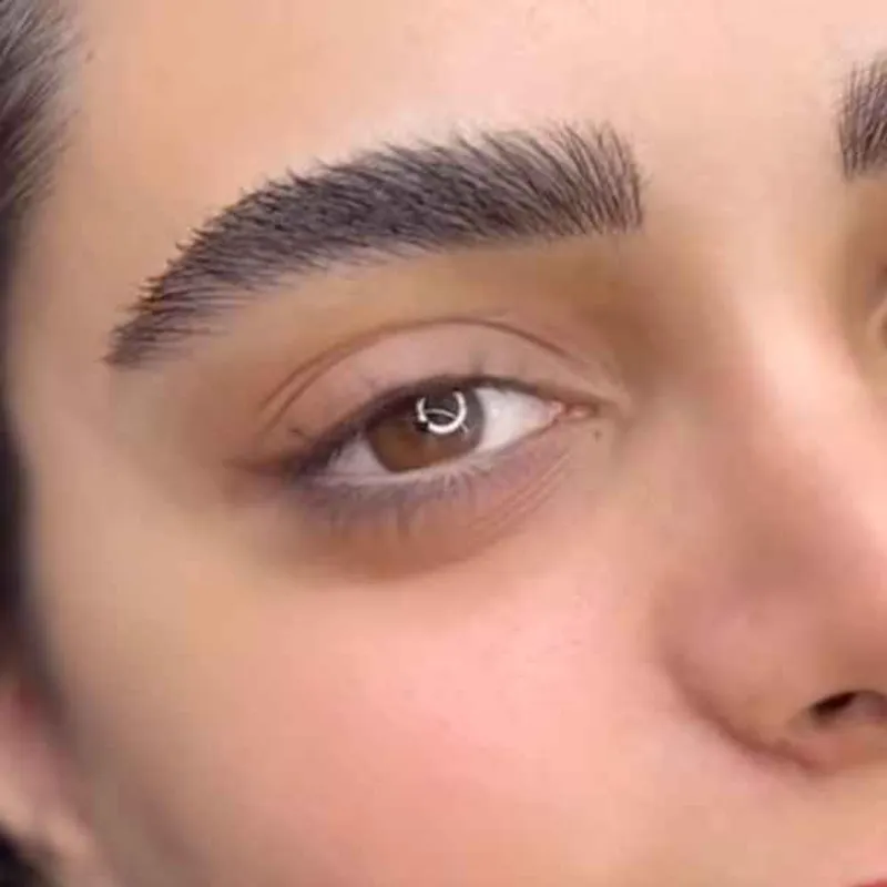 میکروبلیدینگ 