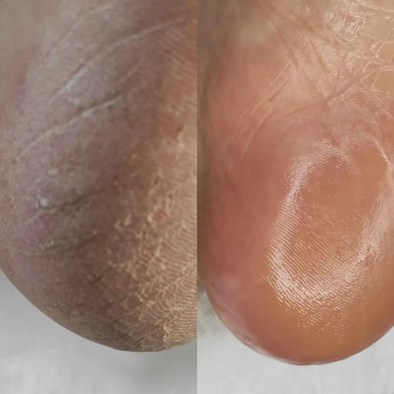 پدیکور درمانی