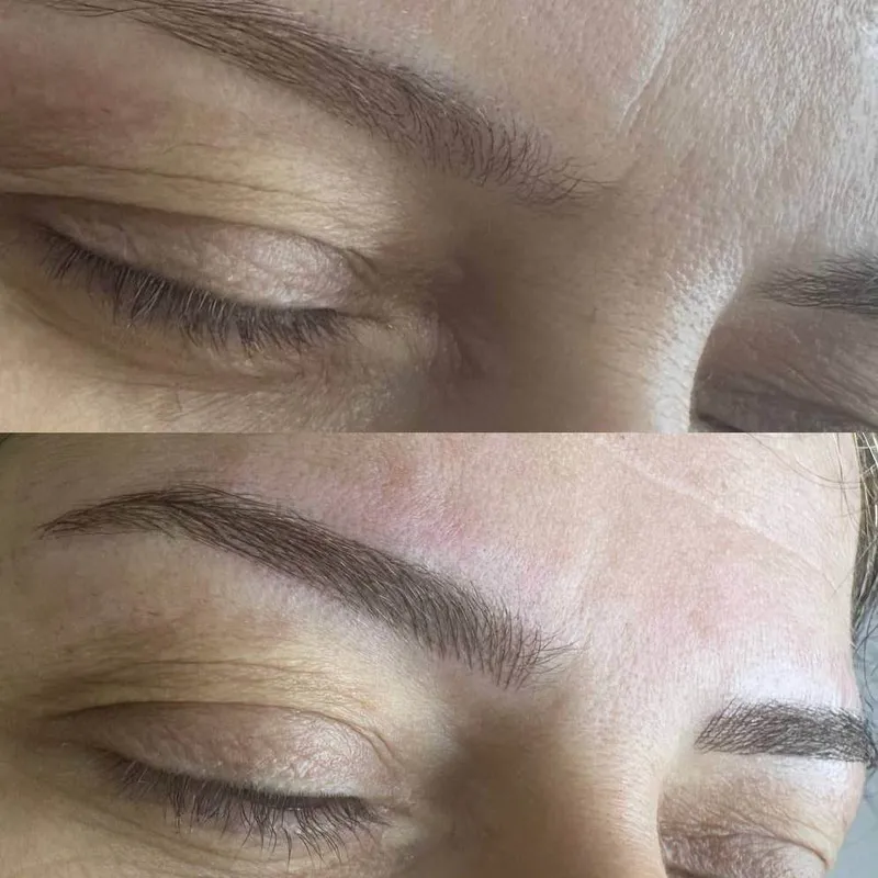 میکروبلیدینگ،فیبروز،نانوبروز،هاشور 