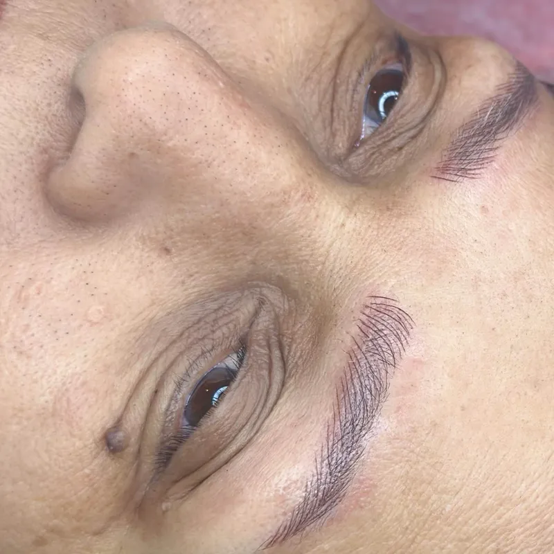 میکروبلیدینگ ،نانو بروز 