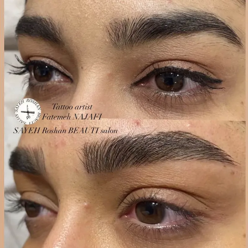 میکروبلیدینگ