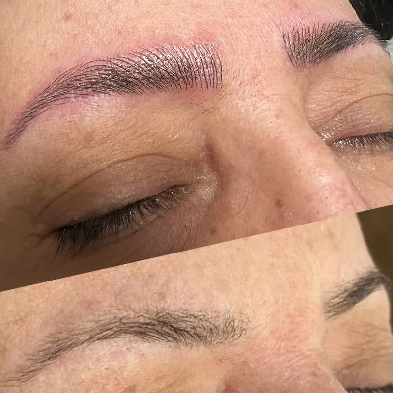 میکروبلیدینگ