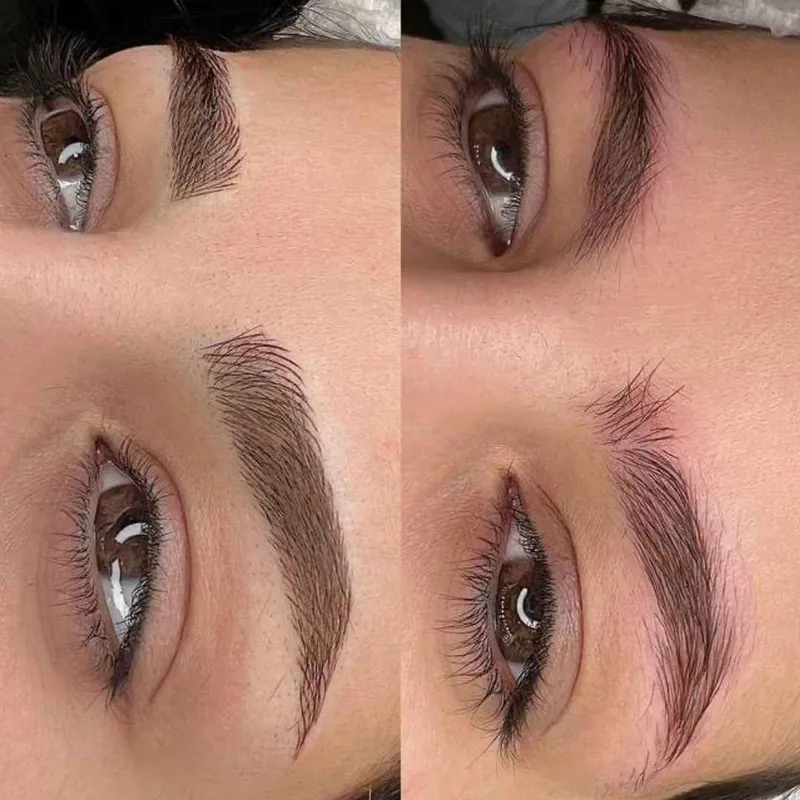 میکروبلیدینگ 